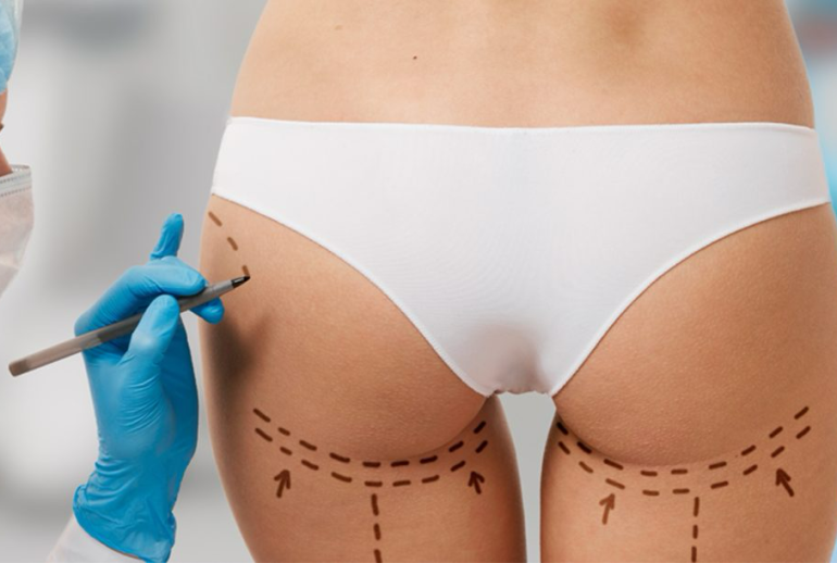 1733052814.001197_804171_image