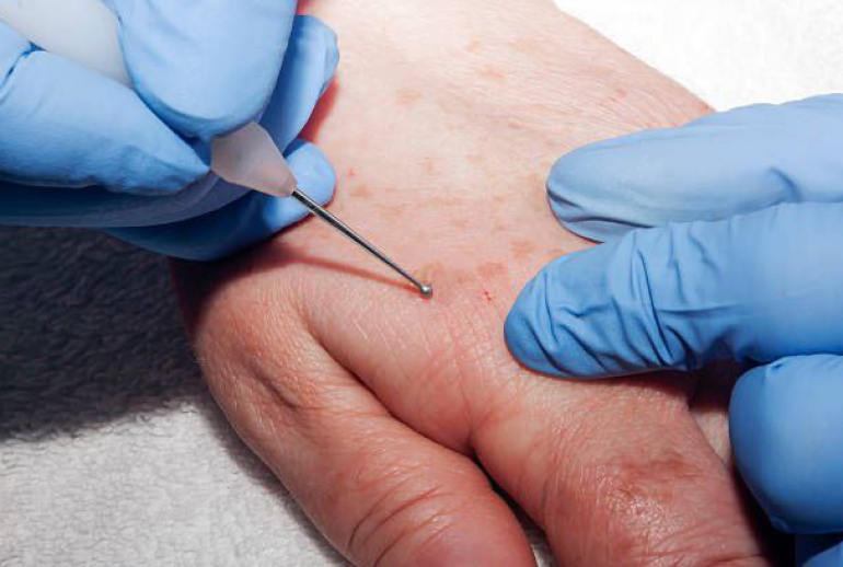 1736930515.569158_493707_image