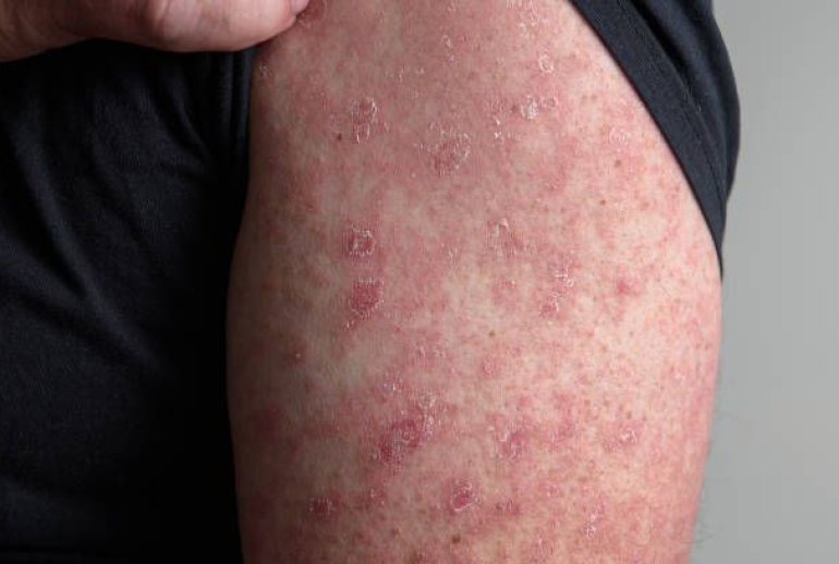 1736930529.672101_943662_image