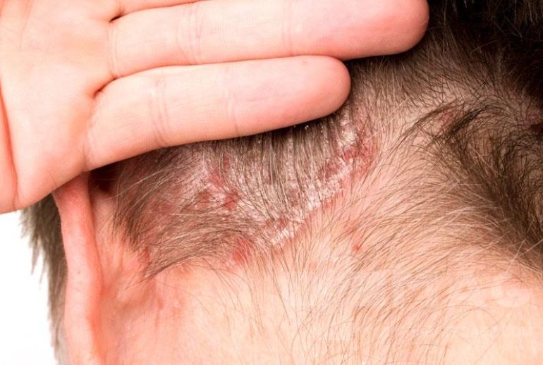 1736930543.126428_585877_image