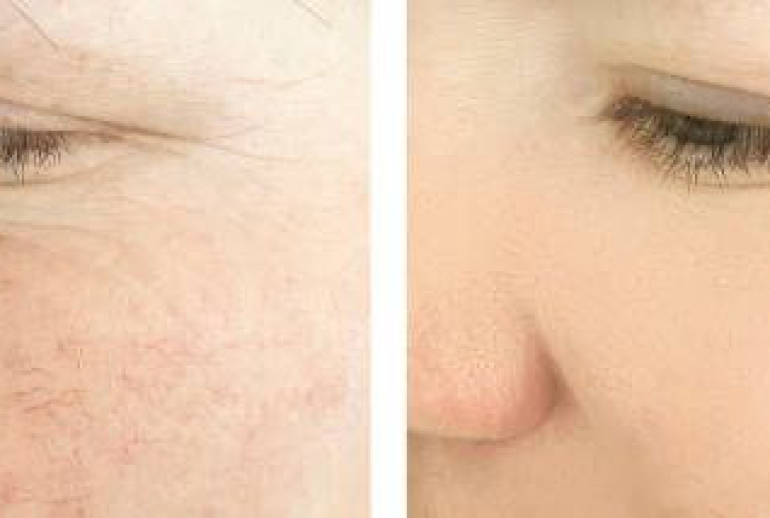 1736949545.780547_845244_image