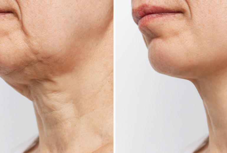 1736954300.891568_856237_image