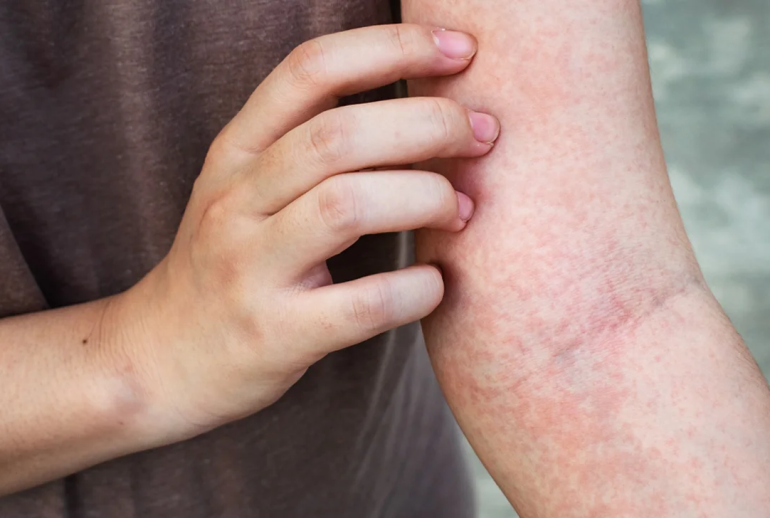 1736954347.62993_770765_image