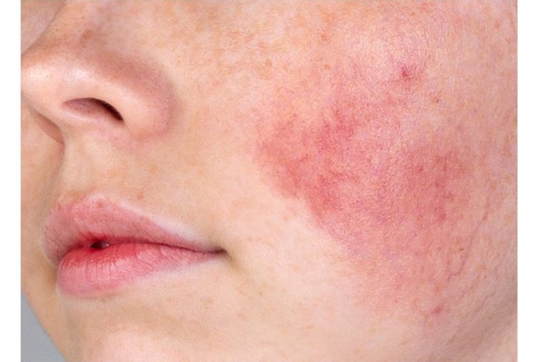 1736954362.539935_834009_image