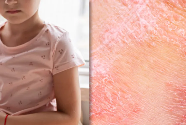 1737324135.132144_517145_image