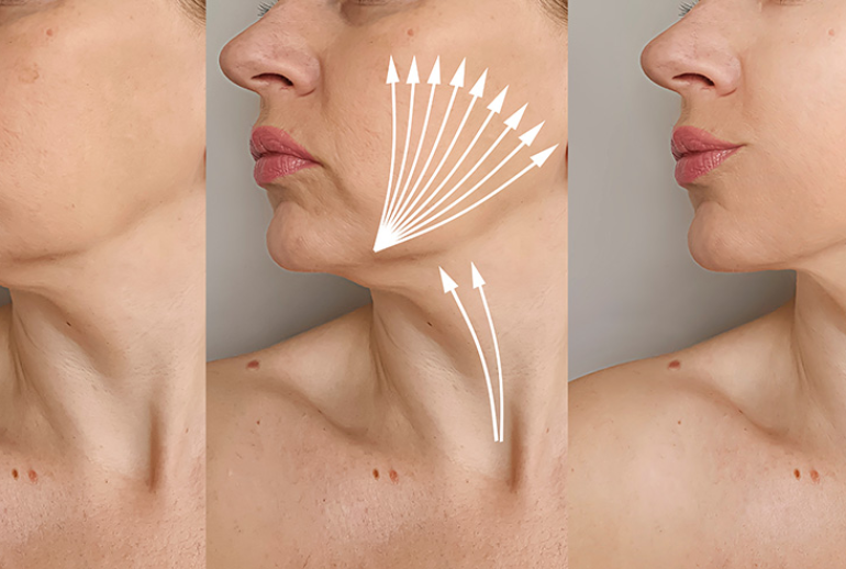 1739542305.761856_105573_image