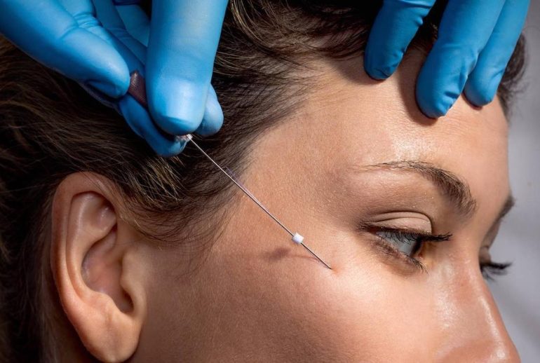 1739542404.066209_549360_image