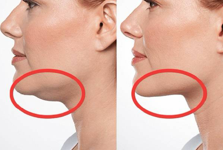 1739542542.900627_429727_image