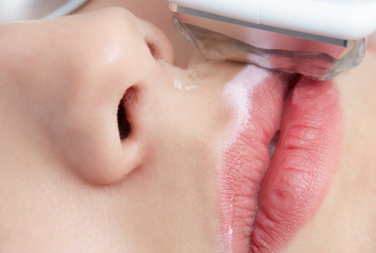 1739542722.588801_550007_image