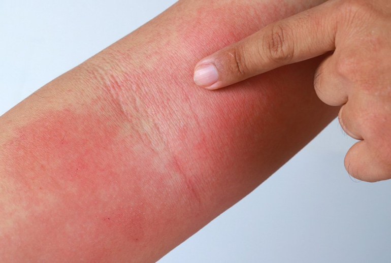 1739542760.282583_856258_image