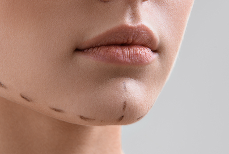 1739542831.939944_235354_image