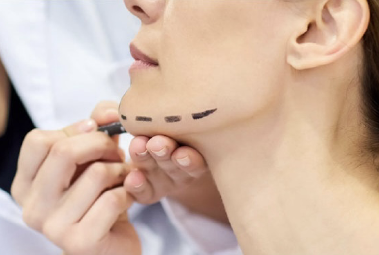 1739543144.783579_160801_image